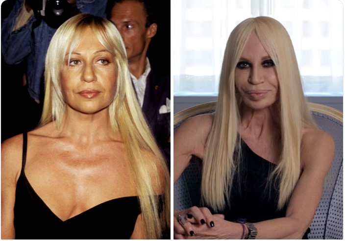 Donatella Versace - Celebrities that look like entirely different people before fame